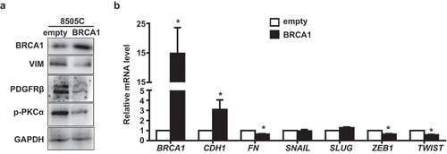 Figure 3. Overexpression of BRCA1 in human thyroid cancer cells inhibits EMT. 8505C cells transfected with pBabe-empty (empty) and pBabe-HA-BRCA1 (BRCA1) were analyzed by Western blot (a) or qRT-PCR (b). GAPDH was used as a loading control in Western blot.