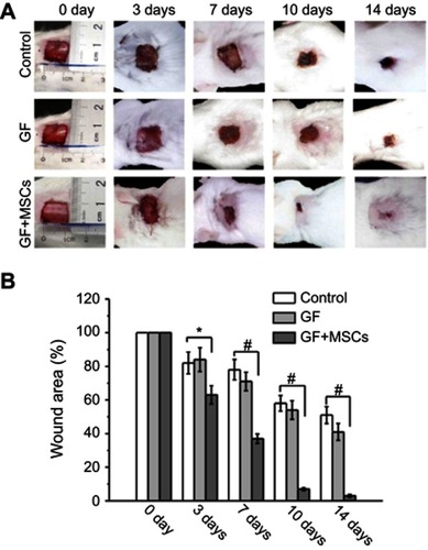 Figure 9 Evaluation of the wound healing effect of GF and GF + MSCs in the in vivo models. (A) Images of the different wound post-transplantation of 3, 7, 10, and 14 days. (B) Graph of wound area (%) in the experimental groups with the implantation time. Data were presented by means ± SEM. *p<0.05 and #p<0.01.Notes: Reprinted from Li Z, Wang H, Yang B, Sun Y, Huo R. Three-dimensional graphene foams loaded with bone marrow derived mesenchymal stem cells promote skin wound healing with reduced scarring. Mater Sci Eng C. 2015;57:181–188. Copyright 2015, with permission from Elsevier.Citation203