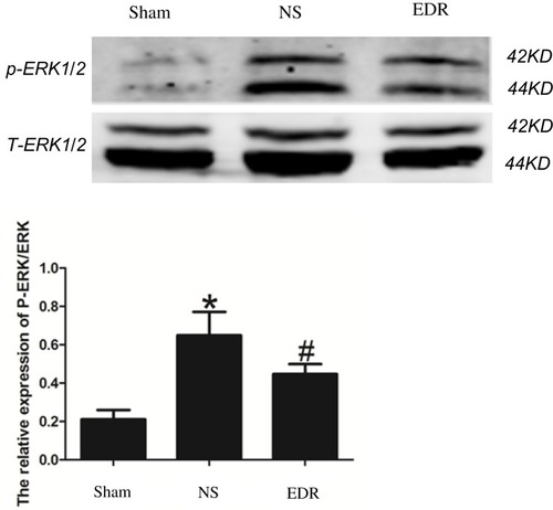 Figure 3 Western blot of total and phosphorylated ERK1/2 among the 3 groups. Data are expressed as the mean ± SD. ∗p < 0.05 versus Sham. #p < 0.05 versus NS group.