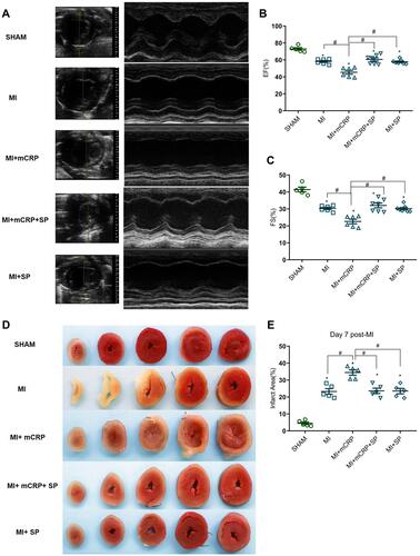 Figure 6 Effects of mCRP and the JNK inhibitor (SP600125) on the cardiac function and infarct size in MI mice. (A) Representative long-axis or short-axis echocardiographic images of mice at 7-days after myocardial infarction in each group. (B and C) Quantitative analysis of cardiac function of EF (%) and FS (%) in mice in each group. (D) Representative TTC stained image of each mice group. The area at risk is stained as red and the infarcted myocardium is stained as white. (E) Quantitative analysis of ratio of infarct size. n = 5–7 per group. Data are presented as mean ± SD. *p<0.05 vs sham group; #p<0.05.