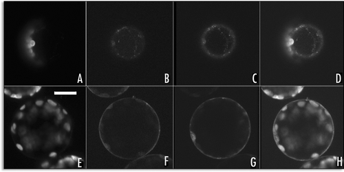 Figure 7 SP1-GFP fluorescence colocalised with FM4-64 staining: (A–D) protoplast expressing the SP1-GFP for 6 hours, (A) chlorophyll auto fluorescence, (B) FM4-64 fluorescence, (C) GFP fluorescence, (D) merge of the four channels; (E–H) protoplast expressing the SP1-GFP for 24 hours, (E) chlorophyll auto fluorescence, (F) FM4-64 fluorescence, (G) GFP fluorescence, (H) merge of the four channels. Scale bar = 20µ.