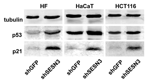 Figure 9. Effect of SESN3 downregulation caused by RNA interference on p53 and p21Cip1/WAF1 content. Western blot analysis was performed as described in “Materials and Methods.” Typical result of one of three experiments is presented.