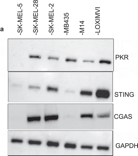 Figure 3. Melanoma cell lines display variable levels of anti-viral machinery elements. Total cell lysates were collected from the indicated cell lines (2 × 106) and 40 µg of lysate was loaded onto an SDS-PAGE gel and transferred to a PVDF membrane. Antibodies against protein kinase R (PKR), cyclic-GMP-AMP synthase (cGAS) and stimulator of interferon genes (STING) were used in immunoblotting assay as described in Methods. Immunoblots of PKR (A), cGAS and STING. GAPDH is loading control.