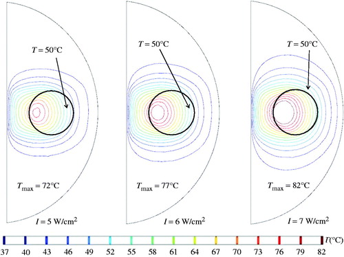 Figure 7. Coronal views of the steady-state temperature field under three different laser intensities.