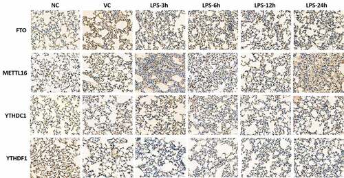 Figure 6. Immunohistochemical tests of FTO, METTL16, YTHDC1, YTHDF1 and YTHDF3 in right lung tissue of ARDS mouse. Magnification: 400 ×.