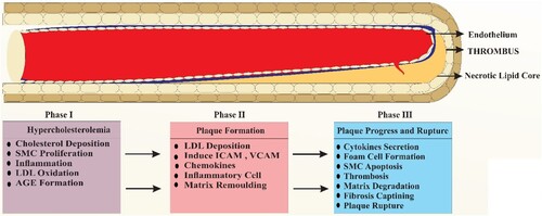 Figure 2. This figure illustrates the sequence for the formation of plaque. Each of these phases has its relationship with each other. However, the progression of these phases can become unavoidable on the severity of the preceding phase.