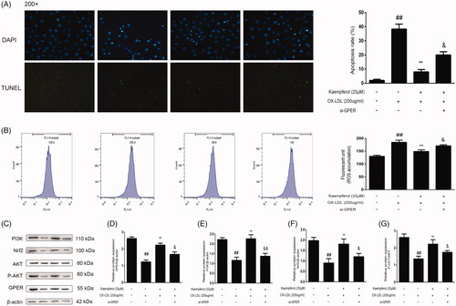 Figure 10. GPER is involved in the effect of kaempferol on apoptosis, ROS and PI3K/AKT/Nrf2 pathway. HAECs cells were treated with kaempferol or kaempferol and si-GPER or free-foetal medium. Then, the cells were treated with indicated drugs or complete medium. The changes in apoptosis (A), ROS accumulation (B), GPER and PI3K/AKT/Nrf2 pathway (C–G) are shown. Data are analysed by one-way ANOVA and unpaired t-test and presented as the mean ± SD. ##p < 0.01 vs. the control group. *p < 0.05 and **p < 0.01 vs. the ox-LDL group. &p < 0.05 and &&p < 0.01 vs. the kaempferol + ox-LDL group (n = 5).