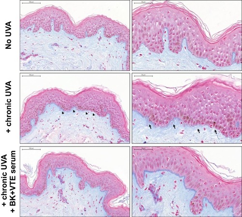 Figure 4 Combined BK+VTE, formulated as a serum, improves dermal density in an ex vivo human skin aging assay. Skin explants were chronically exposed to UVA radiation. After each UVA dose, BK+VTE serum was applied topically onto the skin surface. Tissues were then processed by routine Alcian blue staining to evaluate the GAG content as a marker of the extracellular matrix. Pictures were acquired by photon microscopy. Arrows indicate GAG loss at the dermo-epidermal junction. Left panels show low magnification with scale bar at 100 µm. Right panels show high magnification with scale bar at 50 µm.