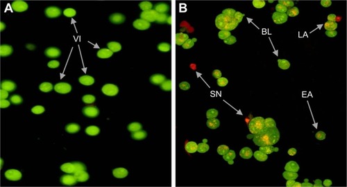 Figure 6 Fluorescent analysis using and AO/PI staining in control viable cells (A) and koenimbin-induced PC-3 cells (B) after 48 h.