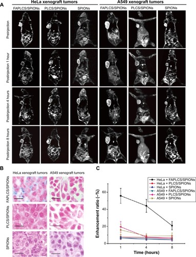 Figure 9 Images of xenograft tumors treated with various contrast agents.Notes: T2-weighted MRI images of central regions of HeLa xenograft tumors and A549 xenograft tumors before and at 1 hour, 4 hours, and 8 hours after injection of FAPLCS/SPIONs or PLCS/SPIONs (A). Images of Prussian blue-stained and nuclear fast red-counterstained HeLa and A549 xenograft tumor sections after intravenous injection of FAPLCS/SPIONs and PLCS/SPIONs in mice; scale bar =20 μm (B). T2-weighted MRI signal intensity changes in regions of interest (C).Abbreviations: FAPLCS, folate-conjugated N-palmitoyl chitosan; SPION, superparamagnetic iron oxide nanoparticle; PLCS, N-palmitoyl chitosan; MRI, magnetic resonance imaging.
