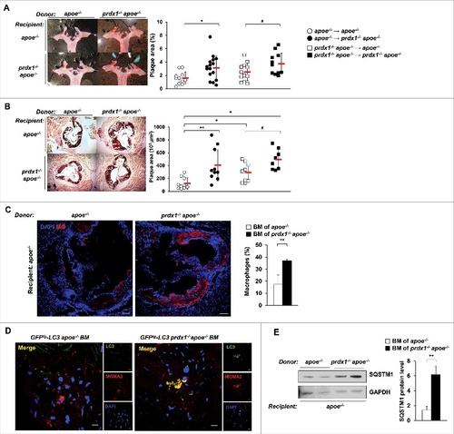Figure 6. Impaired lipophagic flux in Prdx1-deficient haematopoietic cells exacerbates plaque formation in apoe−/− mice. Bone marrow (BM) from apoe−/− or prdx1−/−apoe−/− mice was transplanted into apoe−/− or prdx1−/−apoe−/− recipients. Four weeks after transplantation, mice were fed an atherogenic diet for 10 wk. Representative images of Oil Red O staining of aortas (A) and aortic sinuses (B) from apoe−/− and prdx1−/− apoe−/− recipient mice transplanted with apoe−/− or prdx1−/−apoe−/− BM (n = 11–16 per group). Quantitative data represent plaque percentage (%) or size. (C) Representative immunostaining images of the macrophage marker CD68 in apoe −/− recipient mice transplanted with BM from apoe−/− or prdx1−/−apoe−/− donors (n = 10 per group). CD68 is shown in red and nuclei in blue. Scale bars: 100 μm. Quantitative data in the graph represent the percentage of the total plaque area that was positively stained. (D) Representative confocal microscopy images of plaques from apoe−/− mice transplanted with BM cells from GFPtg-LC3 apoe−/− or GFPtg-LC3 prdx1−/−apoe−/− mice (n = 3 per group). LC3 is shown in green, macrophages in red, and nuclei in blue. Scale bar: 10 μm. (E) Immunoblot analysis of SQSTM1 expression in extracts from the aortas of apoe −/− recipient mice transplanted with BM from apoe−/− or prdx1−/−apoe−/− donors. Quantitative data represent the fold change after normalizing LC3B-II, LC3B-I and SQSTM1 band intensity to GAPDH. *P < 0.05 and **P < 0.01 versus apoe −/− recipient mice transplanted with apoe−/− BM; # P < 0.05 versus prdx1−/−apoe−/− recipient mice transplanted with apoe−/− BM, by the Mann-Whitney test. Data represent the mean ± SEM.