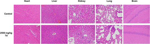 Figure 7 Histological analysis of heart, liver, kidney, lung and brain for the acute toxicity studies of compound 7d at a dosage of 2500 mg/kg in mice. Representative images of HE-stained are shown. Bar = 200 mm.