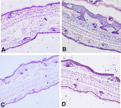 Figure 8 HE staining. (A) Healthy group (200 ×); (B) model group; (C) ECPN group; and (D) positive control group.