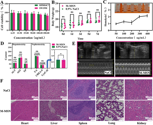 Figure 3 (A) Viability of SW1990 and HPDE6C7 cells after 24 h of treatment with M-MSNs. (B) the changes in nude mouse weight over one week (n = 5, ns: p>0.05). (C) The hemolytic efficiency of M-MSNs on erythrocytes. (D) Biochemical indicators of liver and kidney function (n = 5, ns: p>0.05). (E) Echocardiography of tumour-bearing nude mice. (F) H&E-stained images of organs dissected from the nude mice after treatment with 0.9% NaCl and M-MSNs (scale bars:50 µm).