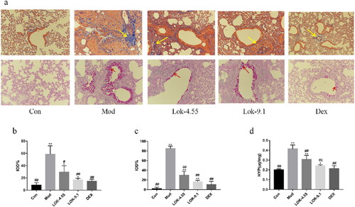 Figure 7. Effect of Lok treatment on OVA-induced airway remodeling in chronic asthma. (a) Masson's trichrome and Periodic Acid-Schiff (PAS) staining in lung tissue. Yellow arrows indicate collagen deposition, and red arrows indicate goblet cell proliferation in each group. Bars, 200 µm. (b) We quantified and outlined the peribronchial area stained with Masson's trichrome. (c) Percentage of PAS staining. (d) The levels of HPY expression in lung tissue. The obtained data are expressed as mean ± SD. n = 6, *p < 0.05, **p < 0.01, vs. con, #p < 0.05, ##p < 0.01, vs. Mod.