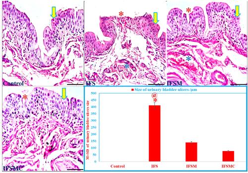 Figure 4 Mesna and MCC effects on the structure of urinary bladder (UB) of IFS-induced HC. The UB of the control and IFSMC groups exhibit the normal structure of the transitional epithelium (yellow arrow). In contrast, the UB of the IFS group reveals a large mucosal ulcer (red *) and congested blood vessels (blue *). At the same time, the IFSM group exhibits a mild improvement of the UB structure with a small ulcer (red *) compared to the IFS group. H&E; 200x, bar = 100 µm. Statistical analysis of the size of UB mucosal ulcers. *P<0.05 vs the control and @P<0.05 vs the IFSMC group.