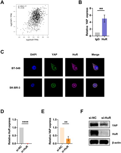 Figure 4. Detection of YAP binding to HuR in BC cells. (A) Analysis of the GEPIA database revealed a positive correlation between HuR and YAP in BC samples. (B) The RIP assay demonstrated that the HuR antibody significantly enriched YAP mRNA in BC cells. (C) The FISH assay verified the colocalization of endogenous HuR and YAP in cytoplasm. (D) Knockdown efficiency of HuR in BC cells. (E-F) Following HuR knockdown, mRNA (E) and protein (F) expression of YAP were downregulated. Data are mean ± SD for triplicate experiments. *p < 0.05, **p < 0.01, ***p < 0.001.