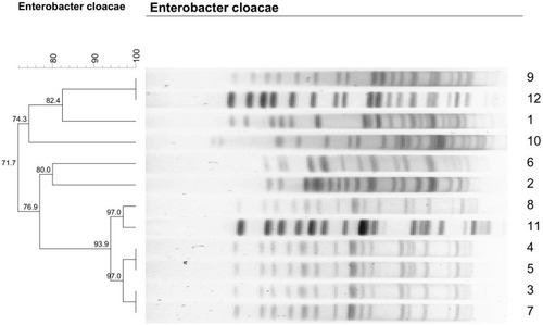 Figure 2 Dendrogram of patterns for carbapenem-resistant Enterobacter cloacae isolates obtained by PFGE.