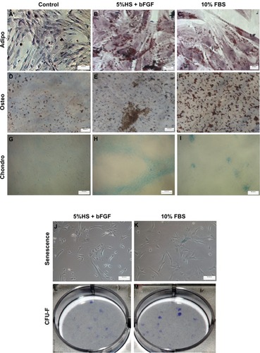 Figure 4 WJ-MSCs expanded in 5% HS + 2 ng/mL bFGF were subjected to adipogenic (n = 3) (B), osteogenic (n = 2) (E), and chondrogenic differentiation (n = 3) (H) and stained with Oil red O, Von Kossa, and alcian blue, respectively. Corresponding FBS cultures were induced to differentiate for reasons of comparison (C, F, and I). Noninduced control cultures without differentiation stimuli are shown in A, D, and G. Senescence-associated β-galactosidase staining of WJ-MSCs (n = 2) at passage 7–8, cultured in 5% HS + 2 ng/mL bFGF and 10% FBS, is demonstrated (J and K). CFU-F colony formation (day 14) initiated from passage 3–4 WJ-MSCs expanded in 5% HS + 2 ng/mL bFGF and 10% FBS (L and M). Representative results of two independent WJ-MSC preparations are demonstrated. (Scale bar for A–F = 20 μM; G–L = 100 μM.)