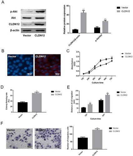 Figure 4 The overexpression of CLDN12 significantly promoted the malignant phenotype of fetal-osteoblast line cell. (A) Western blotting was utilized to examine the expression of CLDN12 and the activities level of the Akt protein. (B) The expression location of CLDN12 was detected via immunofluorescence. The CLDN12 protein was stained with red color and the nuclear was stained with blue color. (C) Growth curve of hFOB.1.19 cells detected by the CCK-8 assay. (D) The abilities of hFOB.1.19 cells to form colonies under 2D culture conditions were determined via the colony formation assay. (E) The wound-healing assay was utilized to explore the migration ability of hFOB.1.19 cells in vitro. (F) The Transwell chambers method was utilized to explore the impact of CLDN12 overexpression on the migratory ability of hFOB.1.19 cells in vitro. **P<0.01, compared with the vector group.Abbreviations: CLDN12, claudin-12; CCK-8, Cell Counting Kit-8.