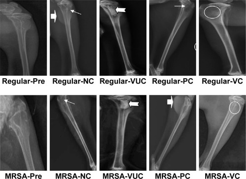 Figure 10 Radiographic performance.Notes: Regular-Pre means presurgery in the regular S. aureus group; the solid arrow (→) represents a bone defect; the arrowhead (⇨) represents reactive ossification; the swallowtail arrowhead (Display full size) represents the enlarged medullary cavity; the circle represents bone healing.Abbreviations: MRSA, methicillin-resistant Staphylococcus aureus; VC, vancomycin-loaded bone-like hydroxyapatite/poly amino acid group; VUC, bone-like hydroxyapatite/poly amino acid group; PC, vancomycin-loaded polymethyl methacrylate group; NC, simulated body fluid group.
