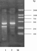 Figure 5 Reverse transcriptase-polymerase chain reaction results against collagen types I and II of chondrocytes according to culture after 14 days within Col/Chi/HA scaffold. 1 = collagen type II and GAPDH; 2 = collagen I and GAPDH; M = 100 bp, 250 bp, 500 bp, 750 bp, 1000 bp and 2000 bp DNA ladder.