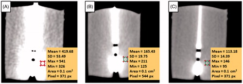 Figure 3. Effects of metal artifacts on the CT images for three set of different reconstructed slice thicknesses: (A) 1 mm, (B) 5 mm and (C) 10 mm, respectively. The targeted circular area shows the CT number on the particular ROI.