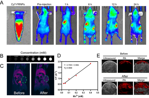 Figure 6 In vivo biodistribution studies and multimodal imaging of FRNPs. (A) In vitro fluorescence imaging of Cy7 -FRNPs and in vivo fluorescence imaging of ECA 109 tumor-bearing mice after the treatment of Cy7 -FRNPs for pre-injection, 1, 6, 12, and 24 h. (B) T1-weighted MR images of FRNPs solutions at various concentrations. (C) In vivo MR images of mice before and after i.v. injection with FRNPs, green circled area identified tumor site. (D) T1 relaxation rates (R1) of FRNPs solutions at different Mn concentrations. (E) In vivo PA images of mice before and after i.v. injection with FRNPs.