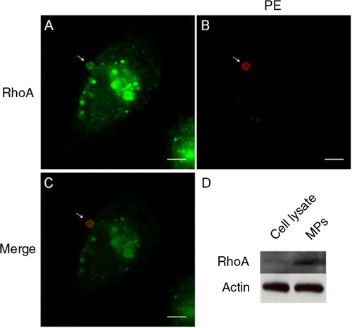 Fig. 4.  Colocalisation of native RhoA in MPs. A–C, the presence of native RhoA in MPs, as detected by immunocytochemistry, is colocalised with PE staining from the outer surface. D, MPs harvested from the culture media contained relatively high levels of native RhoA compared to total cell lysate, as detected using Western blotting. Scale bars represent 5 µm.
