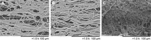 Figure 6 SEM images of BMSCs on scaffolds.Notes: At day 7 after culture, BMSCs on AFS (A), AYS (B), and HS (C) were imaged. The scale bars in (A–C) represent 100 μm.Abbreviations: AFS, aligned nanofiber scaffolds; AYS, aligned nanoyarn scaffolds; BMSCs, bone marrow-derived mesenchymal stem cells; HS, hybrid scaffold; SEM, scanning electron microscope.