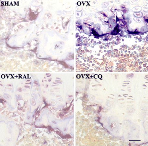 Figure 4.  Histochemical localization of tartrate-resistant acid phosphatase (TRAP) in bone sections of sham control (SHAM), ovariectomized (OVX), ovariectomized and raloxifene-treated (OVX + RAL) and ovariectomized and Cissus quadrangularis extract-treated (OVX + CQ) groups. Note the increased activity of TRAP in the OVX Group.