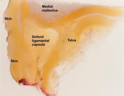Figure 2 Paraffn-embedded specimen of medial ankle.