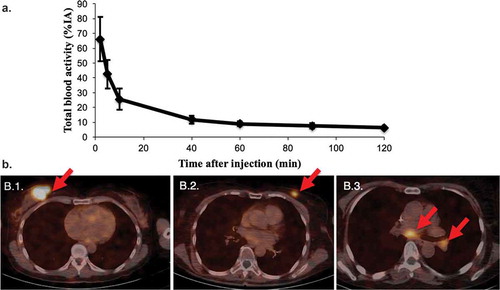Figure 3. Diagnostic tumor imaging using 68Ga-HER2-nanobody in patients with HER2pos-breast cancer. a. Time-activity curve of total blood activity, expressed in % of injected activity (%IA) (n=20). b. Fusion PET/CT images of the uptake of 68Ga-HER2-nanobody in breast carcinoma lesions. (B.1.) Patient with the highest tracer uptake (SUVmean 11.8) in a primary breast carcinoma. (B.2.) Patient with moderate tracer uptake in the left breast, which is easily discernable from background (SUVmean 4.9). (B.3.) Patient with invaded lymph nodes in the mediastinum and left hilar region. Lesions are indicated by red arrows. Figures are adapted with permission from.[Citation110].