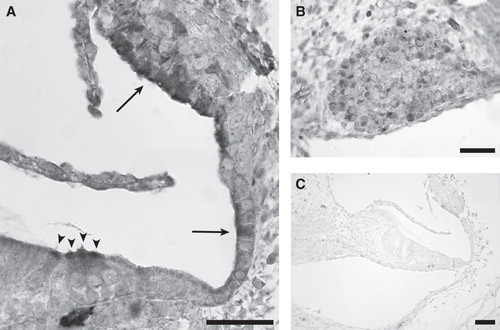 Figure 2. Immunohistochemical staining showed positive immunoreactivity for thioredoxin reductase (TrxR) in P2 rat cochlea. (A) Positive staining was seen in the apical part of inner and outer hair cells (arrowheads), in the developing stria vascularis, and in the cells of Claudius (arrows). (B) Positive staining in the spiral ganglion. (C) Negative control was obtained by omitting primary antibody. Scale bars = 50 µm in A and B, 100 µm in C.