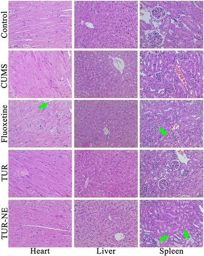 Figure 6 Pathological section images of heart, liver, and kidney in mice (400 × magnification). The green arrow: slight degeneration of the tissue organs.