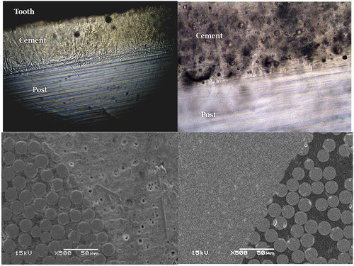 Figure 3. Light microscope and SEM images (500 × magnification) of the interface between FRC post and luting materials (SFRC:left side and PFC:right side).