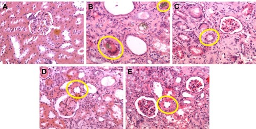 Figure 6 Effects of C. cicadae, P. cicadae, and UCG treatments on adenine-induced morphological changes in the glomerulus.