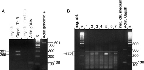 Figure 2.  Agarose gel electrophoresis analysis of PCR products from single-cell degenerate primer PCR. A: Control analyses of the single-cell PCR showing negative and positive control reactions. (Lanes: neg. ctrl., PCR on cDNA reaction without reverse transcriptase; single retinal ganglion cell cDNA analysed using specific primers to Gapdh and TrkB; neg. ctrl. medium, control for extracellular RNA contamination; Actin cDNA and Actin genomic, controls for cDNA synthesis and genomic DNA contamination with primers that give a 138 bp fragment with the actin cDNA and 601 bp with genomic DNA as templates; M, 100 bp DNA size marker ladder). B: PCR on seven representative single cells using degenerate primers directed towards conserved sequences in the tyrosine kinase domain of receptor tyrosine kinases. (Lanes: negative controls and markers as in A; positive control using specific primers for Actin and Gapdh; 1–7, degenerate primer PCR on single retinal ganglion cell cDNA). Specific PCR products are approximately 220 bp. Cells 2, 3, 5, and 7 are considered positive, while 1, 4, and 6 are negative.