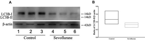 Figure 6 Decreased autophagy after sevoflurane exposure. (A) Western blot analysis of LC3B-II expression in cochlear explant cultures treated with 2.5% sevoflurane for 6 h, n = 10. (B) Quantification of LC3B-II expression in (A). *P < 0.05.