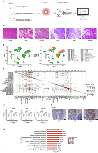Figure 1 Cell heterogeneity of intestinal tissues from rats with severe acute pancreatitis. (A) Schematic diagram of scRNA seq data processing. (B) Representative HE-stained images of pancreatic sections in each group (original magnification, ×200). (C) Representative HE-stained images of ileal sections in each group (original magnification, ×200). (D) UMAP plot of composite single-cell transcriptomic profiles from all 9 samples. Colors indicate cell clusters along with annotations. (E) Dot plots showing the expression of top3 representative genes annotated by cell types in each cell type. (F) Violin plot of S100a8 in each cell type split by different sample groups. (G) Representative images of immunohistochemical staining for the cluster 11 marker S100a8 (red arrows) in CON-SAP-JZL184 (original magnification×200; scale bar=100μm). (H) Bar plot showing the most enriched GO biological process results of cluster 11.