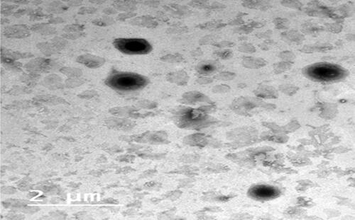 Figure 5. The image of TEM of the picked optimized PBs (F5)..