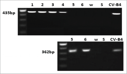 Figure 3. Detection of viral RNA in spleen cells cultures inoculated with CV-B4 E2 in vitro. Spleen cells cultures were inoculated with CV-B4 E2 mixed with serum from 4 infected mice collected day 30 p.i. (lanes 1, 2, 3 and 4) or inoculated with CV-B4 E2 (lanes 5 and 6), MOI 0.02. Agarose gel electrophoresis of amplicons resulting from RT-PCR (top) and semi-nested-RT-PCR (bottom) are presented. CV-B4: supernatant of CV-B4 E2 -infected HEp-2 cell culture, W: purified sterile water ; S: last washing supernatant.