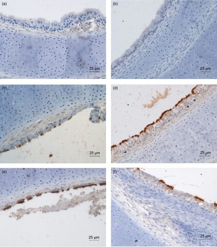 Figure 4. Immunohistochemical staining of aMPV antigen in the epithelial layer of TOC. DAB staining for aMPV-positive epithelial cells in TOC of (a)+(c)+(e) chicken and (b)+(d)+(f) turkey at (a)+(b) 24 hpi (virus-free controls), (c)+(d) 48 hpi (e)+(f) 96 hpi. hpi = hours post infection. Brown staining indicates aMPV-positive cells. The sections are representative for all trials.