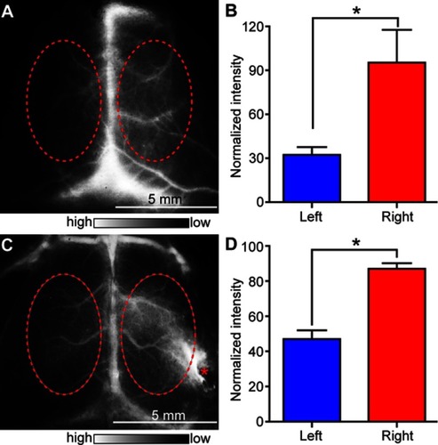 Figure 4 L1013 NPs-based NIR-II fluorescence imaging in two mouse models of stroke. (A) NIR-II fluorescence imaging of cerebral vessels in C57Bl/6 mice with MCAO. (B) Normalized fluorescence intensity of areas outlined in red in (A). (C–D) Same as (A–B), but for the hemorrhagic stroke model. Red asterisk indicates the craniotomy point. Bars show mean ± SD; n=3, *p<0.05.Abbreviation: MCAO, middle cerebral artery occlusion.