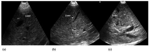 Figure 4. US images of the liver in the three study groups were carried out on the same day of blood collection. (a) The non-HL group, showing homogeneously distributed fine echoes all over the entire liver parenchyma. (b) The mild HL group, showing mild focal white lesions in the liver tissue (arrows). (c) The severe HL group, appearing brighter than the other 2 groups, with severe fatty infiltration over the liver parenchyma (arrows). Abbreviations: AW: abdominal wall; HV: hepatic vein; HP: hepatic lipidosis; US: ultrasound.