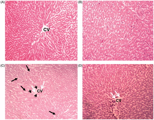 Figure 6. Photomicrographs of H & E (hematoxylin and eosin) stained sections of the liver of control rats and the rats treated with turmeric alone showing (A & B) normal histological structure of the central vein (CV) and surrounding hexagonal hepatocytes. (C) CF-treated rat livers showed severe disruption of the cellular arrangement radiating from the central vein (CV) and in the lobule (long black arrows), degeneration of hepatocytes at the peripheral area of the CV (short black arrows) and congestion in the CV associated with inflammatory infiltrates (white arrows). (D) A liver section of the animals treated with turmeric +CF, showing a remarkable degree of preservation in the cellular arrangement with only mild inflammation observed. [Magnification: 40X].