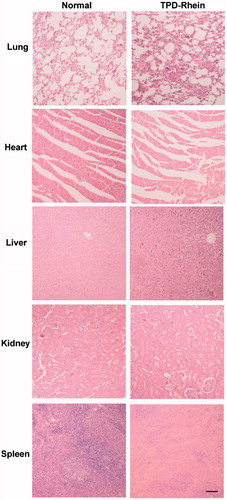 Figure 5. In vivo toxicity evaluation of TPD-Rhein in rats. The major tissues were processed for H&E staining 24 h after the last treatment of TPD-Rhein. No apparent changes were observed in these tissues. Scale bar =100 μm.