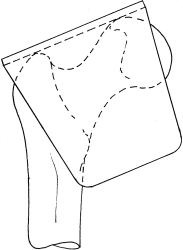 Figure 2. Registration tool position on femur.