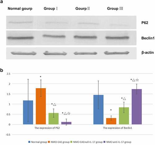 Figure 4. Expression of P62 and Beclin1 protein in each group. (a): Western blot of P62 and Beclin1 protein expression in each group. (b): Statistical difference of P62 and Beclin1 protein expression in each group.