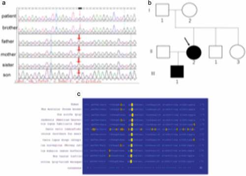 Figure 3. LMNA gene analysis in the pedigree.